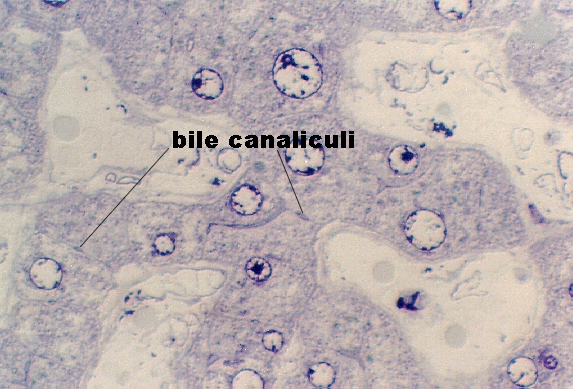 liver9.jpg (248531 bytes)