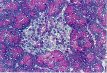 pancreas1.jpg (181313 bytes)