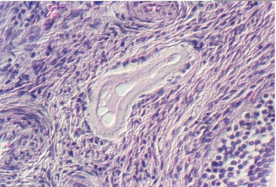 atretic.jpg (99982 bytes)