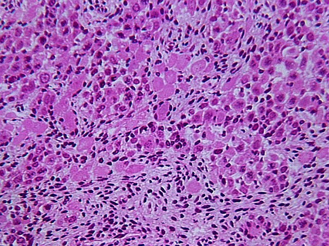 fetal_ovary.jpg (160795 bytes)