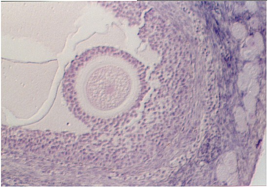 ovary11.jpg (64986 bytes)