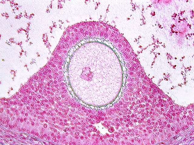 ovary3.jpg (153323 bytes)