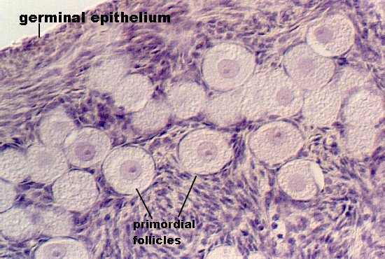 ovary7.jpg (101935 bytes)