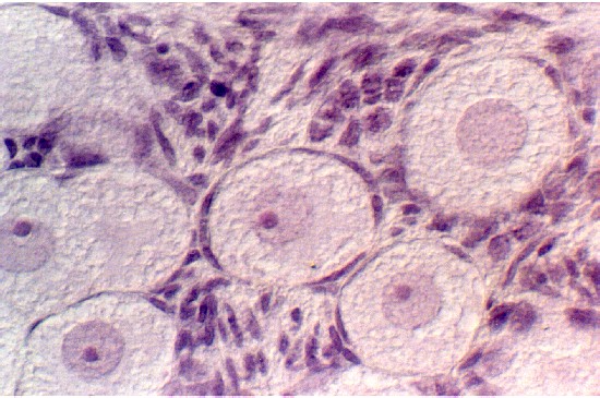ovary8.jpg (86950 bytes)