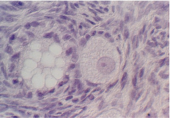 ovary9.jpg (62095 bytes)