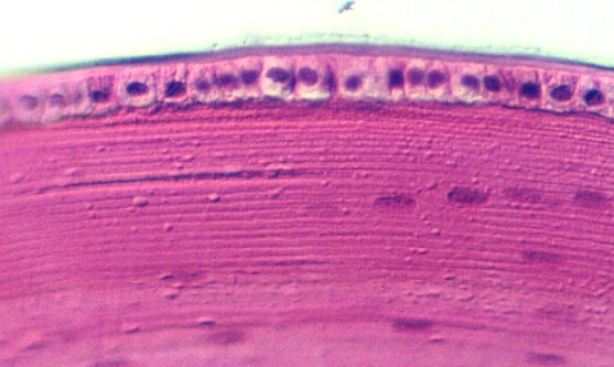 Cornea, Iris, and Lens | Microanatomy Web Atlas | Gwen V. Childs, Ph.D.
