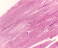 STRIATED, SKELETAL MUSCLE | Microanatomy Web Atlas | Gwen V. Childs, Ph.D.